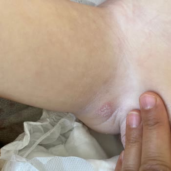 Sleepy Bebek Bezi Tahriş Ve Sızdırma Problemi, Gösterge Sorunu