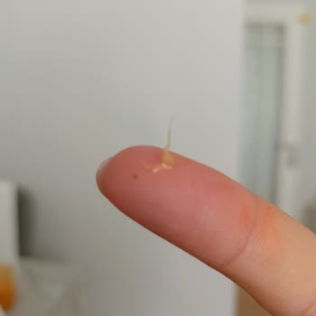 Tereyağında Ambalajı Açınca Çıkan Yabancı Cisimle Yaşadığım Hijyen Şoku