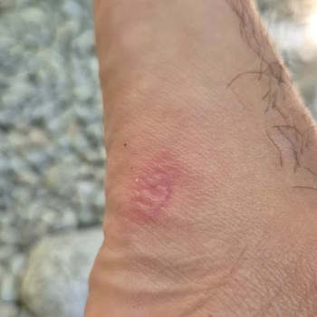 Terlik Kullanımında Oluşan Fiziksel Rahatsızlık Ve Kalite Endişesi