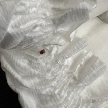 Bebek Bezinde Ne Olduğu Belirsiz Bir Canlı Buldum Açıklama Bekliyorum