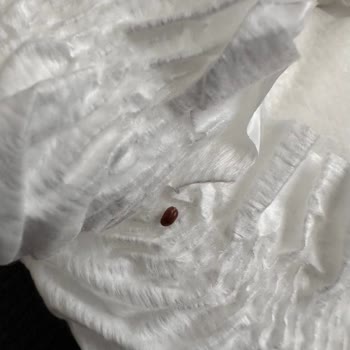 Bebek Bezinde Ne Olduğu Belirsiz Bir Canlı Buldum Açıklama Bekliyorum