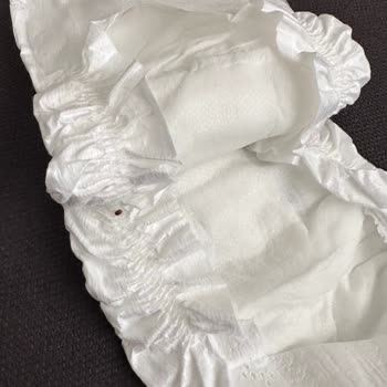 Bebek Bezinde Ne Olduğu Belirsiz Bir Canlı Buldum Açıklama Bekliyorum