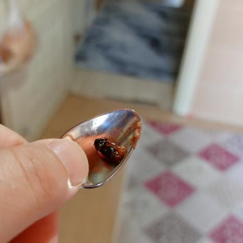 Aldığım Ketçaptan Sinek Çıktı, Şok Oldum!