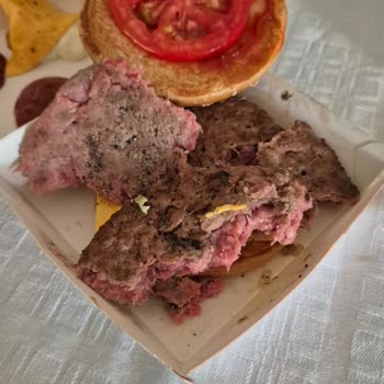 Çiğ Gelen Hamburgerle Sağlığım Tehlikeye Girdi!