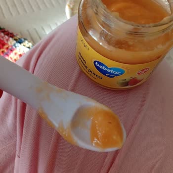 Bebek Mamasının İçinden Böcek Çıkması Nedeniyle Hayal Kırıklığı