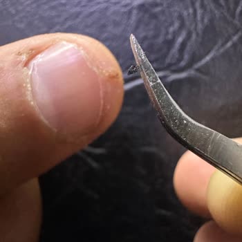 Trende Yaralanma Sonrası Yetersiz Müdahale Ve İlgisizlik