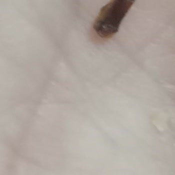 Cipso Cipsin İçinden Böcek Çıktı Ailecek Midemiz Bulandı