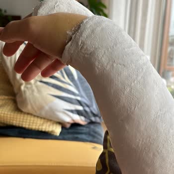 Kaygan Zeminde Düşme Sonrası Tam Bir İlgisizlik