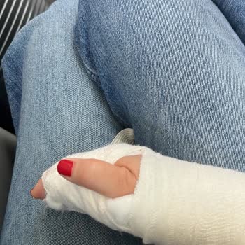 Kaygan Zeminde Düşme Sonrası Tam Bir İlgisizlik