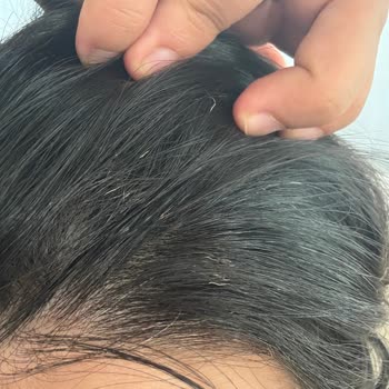 Fantom Jolie HS 1500 Saç Düzleştirici Saçlarımı Yaktı, Hakkımı Arayacağım