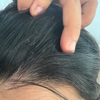 Fantom Jolie HS 1500 Saç Düzleştirici Saçlarımı Yaktı, Hakkımı Arayacağım