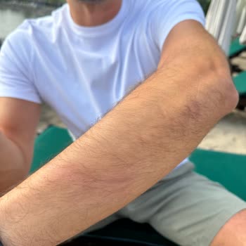 Richmond Nua Wellness Otel'de Gürültü Ve Güvenlik Sorunları: Dinlenme Ve Sağlık Konseptine Aykırı Deneyim