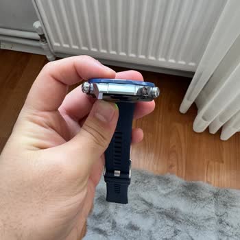 Huawei Watch Ultimate Kordon Bağlantısı Kolayca Kırıldı, Servis Yüksek Ücret Talep Etti