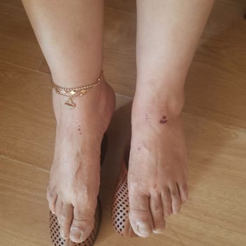 Ayak Yaralanmasına Sebep Olan Ayakkabının İadesinin Gerekçesiz Reddedilmesi