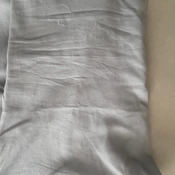 Altınyıldız Pantolonun Tüylenmesi Ve Değişim Talebinin Reddi