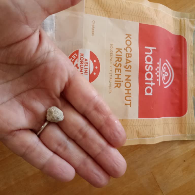 Nohut Paketinden Çıkan Taşlar Nedeniyle Yaşadığım Şok