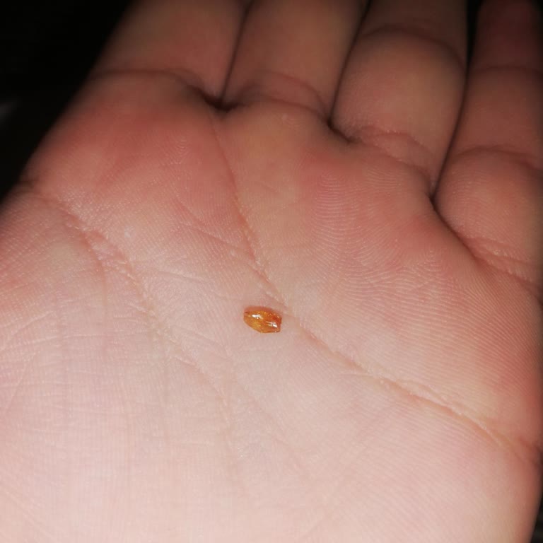 Golf Dondurma Çıkan Cam Parçaları