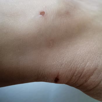 Kısa Sürede Ayağımı Vuran Ayakkabının Değişim Talebi Reddedildi