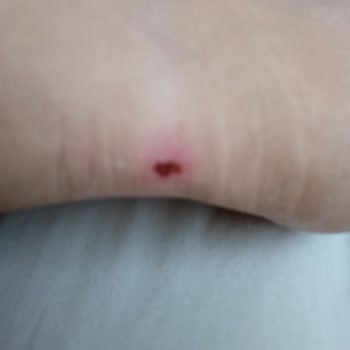 Kısa Sürede Ayağımı Vuran Ayakkabının Değişim Talebi Reddedildi