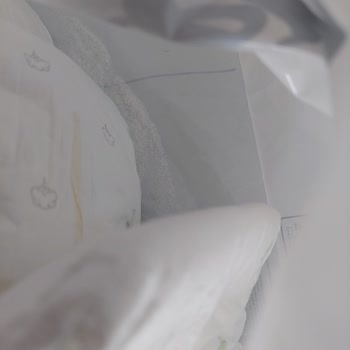 Bebek Bezi İçinden Çıkan Yabancı Maddeler Ve Sağlık Endişesi