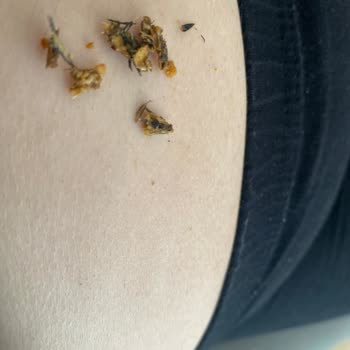 Aldığım Çıtır Leblebinin İçinden Yabancı Madde Çıktı, Sağlığımız Tehlikede!