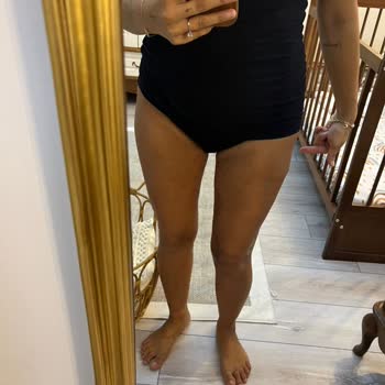 19 Mayıs Üniversitesi Hastanesi Üst Bacak Ameliyat Sonrası Dikişlerde Deformasyon