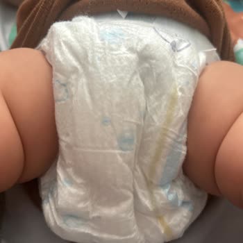 Molfix Bebek Bezinde Islaklık Göstergesi Sorunu Ve Hayal Kırıklığı