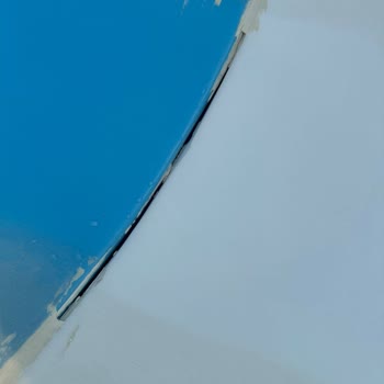 Çocuğumun Havuzda Yaralanması Sonrası Yetersiz Destek Ve Haksız Ücret Kesintisi