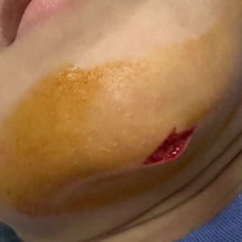 Çocuğumun Havuzda Yaralanması Sonrası Yetersiz Destek Ve Haksız Ücret Kesintisi