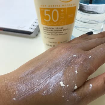 Bioderma Güneş Kremi Bu Yıl Cildimde Leke Ve Yanıklara Neden Oldu
