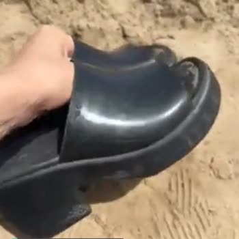 Crocs Ayaklarımı Sürekli Yara Yapıyor