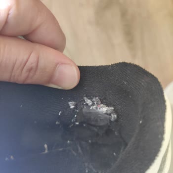 Adidas Ayakkabının Topuk Kısmında Tekrarlayan Yırtılma Sorunu Çözülmedi