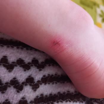 Aldığım Sandalet Ayağımı Yaraladı, Mağaza Değişim Yapmadı