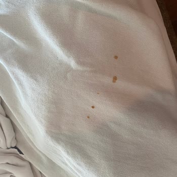 Ultra Her Şey Dahil Otelde Hijyen Sorunu Ve İlgisizlik