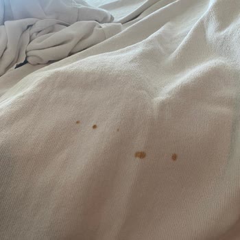 Ultra Her Şey Dahil Otelde Hijyen Sorunu Ve İlgisizlik