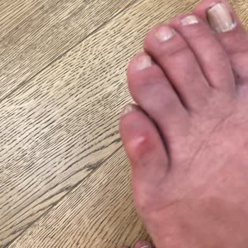 Yeni Alınan Ayakkabının Astarı İlk Giyişte Çıktı, Mağaza Çözüm Sunmuyor