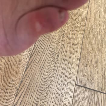 Yeni Alınan Ayakkabının Astarı İlk Giyişte Çıktı, Mağaza Çözüm Sunmuyor