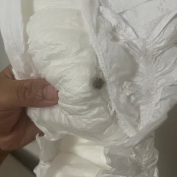 Baby Turco 5 Numara Bebek Bezinde Toz Ve Yabancı Madde Sorunu