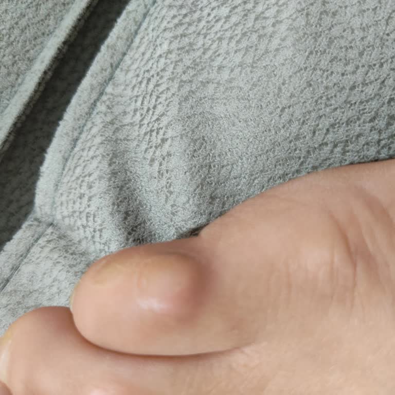 Aldığım Adidas Ayakkabı Ayağımı Yaraladı, Orijinalliğinden Şüpheliyim