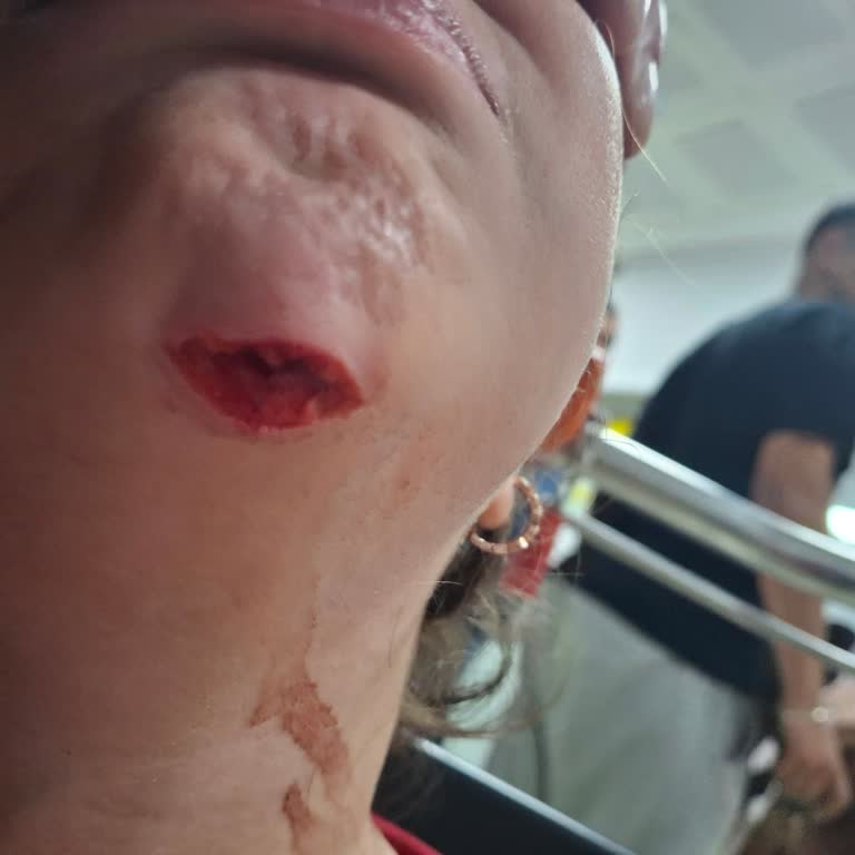 Sivas Belediyesi Parktaki Kaydırak Çocuklar İçin Tehlike Oluşturuyor