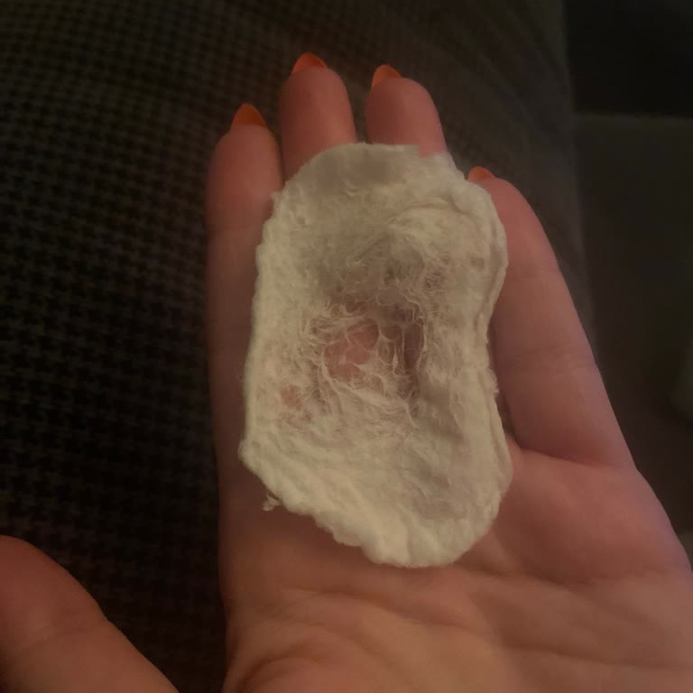 Benri Disk Pamuklarda Kalite Düşüşü Ve İncelik Sorunu