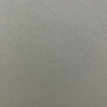 Otel Odasında Çıkan Saçlar Ve Personelin İlgisiz Tavrı Tur Keyfini Bozdu