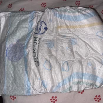 Molfix Bebek Bezinde Yoğun Koku Ve Sağlık Endişesi