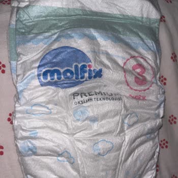 Molfix Bebek Bezinde Yoğun Koku Ve Sağlık Endişesi