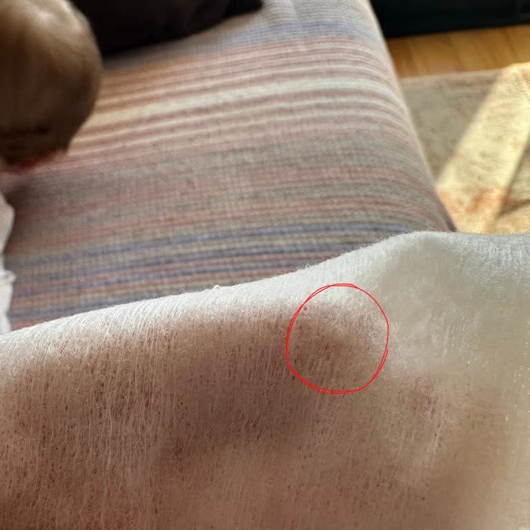 Sleepy Islak Mendilde Kurt Ve Yabancı Cisim Şoku: Bebeğimin Sağlığı Tehlikeye Girdi