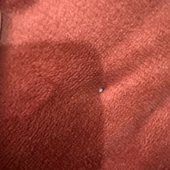 Karaca Yatak Örtüsünden Çıkan Tüyler Hayal Kırıklığı Yaşattı