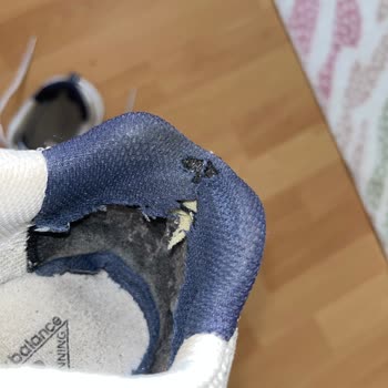 Garanti Süresi İçinde Deforme Olan Ayakkabıya İlgisiz Yaklaşım