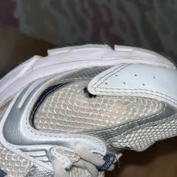 Garanti Süresi İçinde Deforme Olan Ayakkabıya İlgisiz Yaklaşım