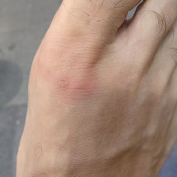 Derimod Aldığım Ayakkabı Ayağımı Yaraladı, Mağaza Müdürünün Olumsuz Tavrı Hayal Kırıklığı Yarattı