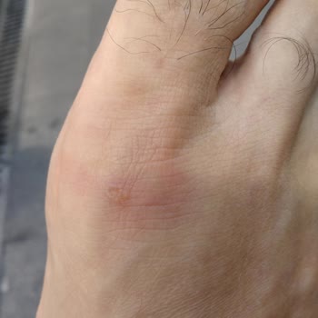 Derimod Aldığım Ayakkabı Ayağımı Yaraladı, Mağaza Müdürünün Olumsuz Tavrı Hayal Kırıklığı Yarattı